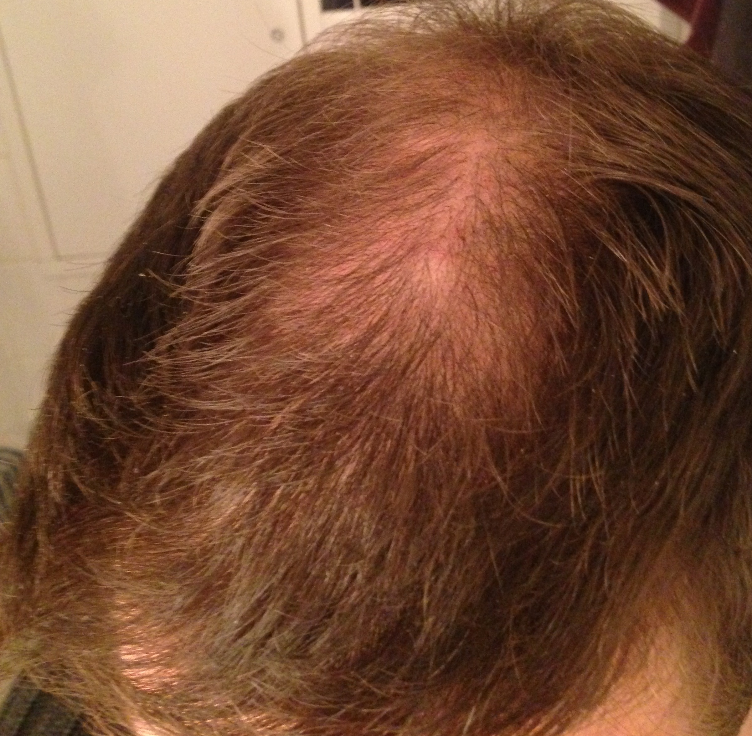 index.php/fa/13062/0/