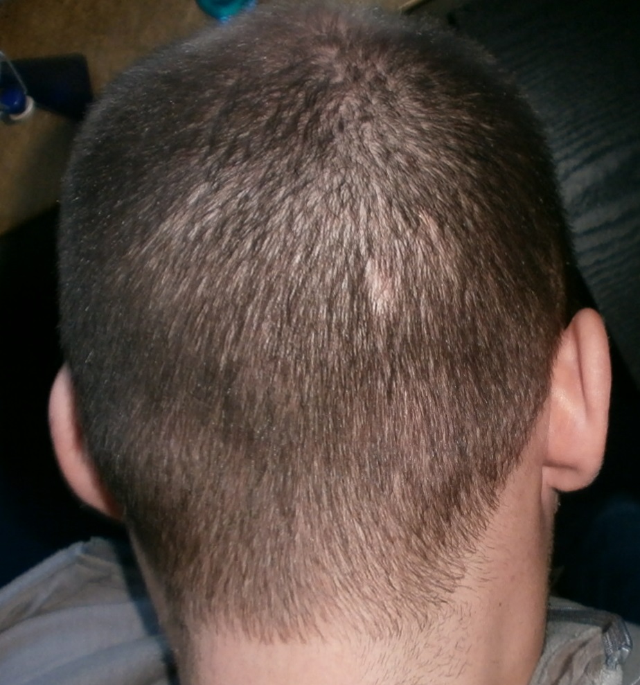 index.php/fa/13382/0/