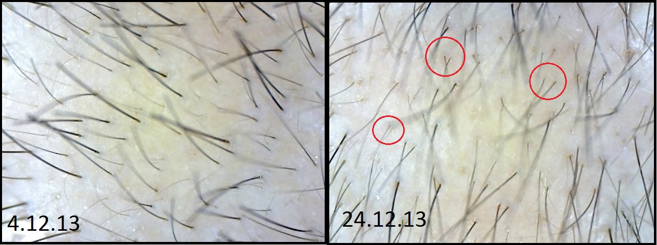 index.php/fa/13419/0/