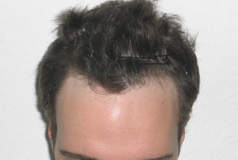 index.php/fa/13672/0/