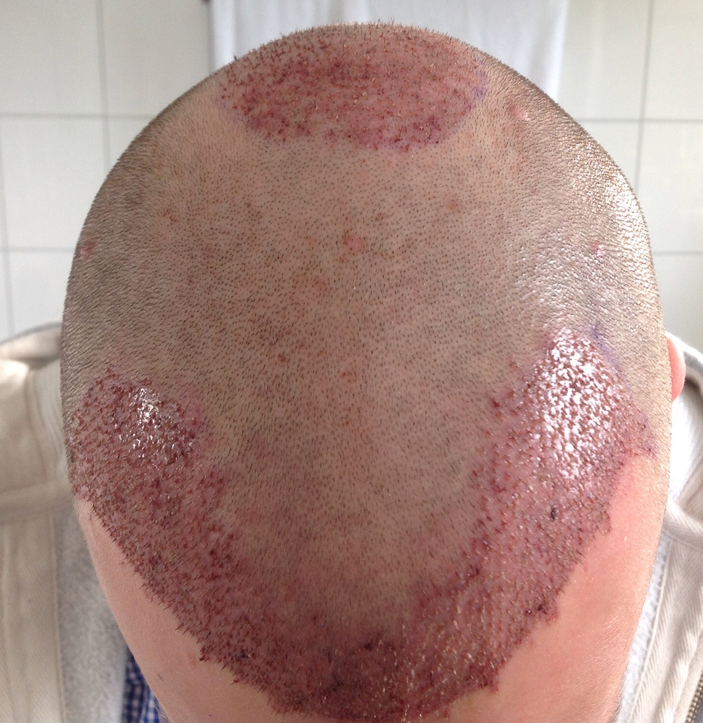 index.php/fa/13785/0/