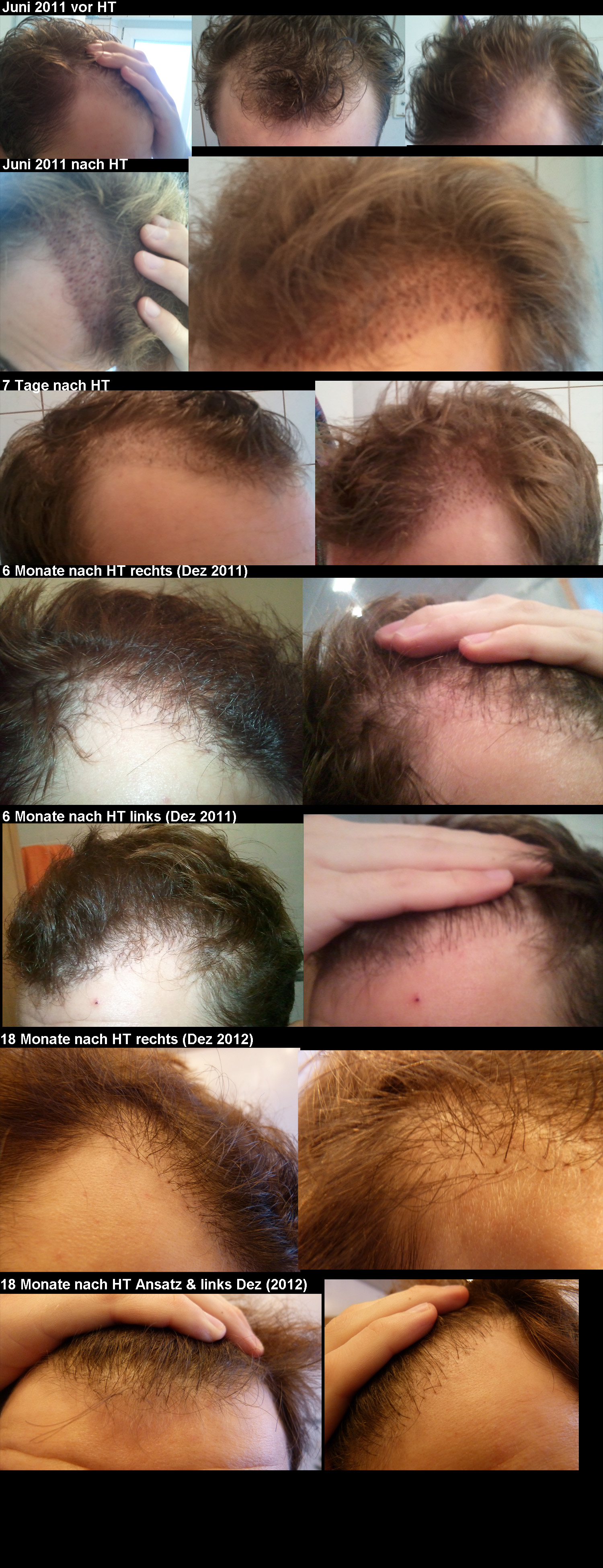 index.php/fa/13932/0/