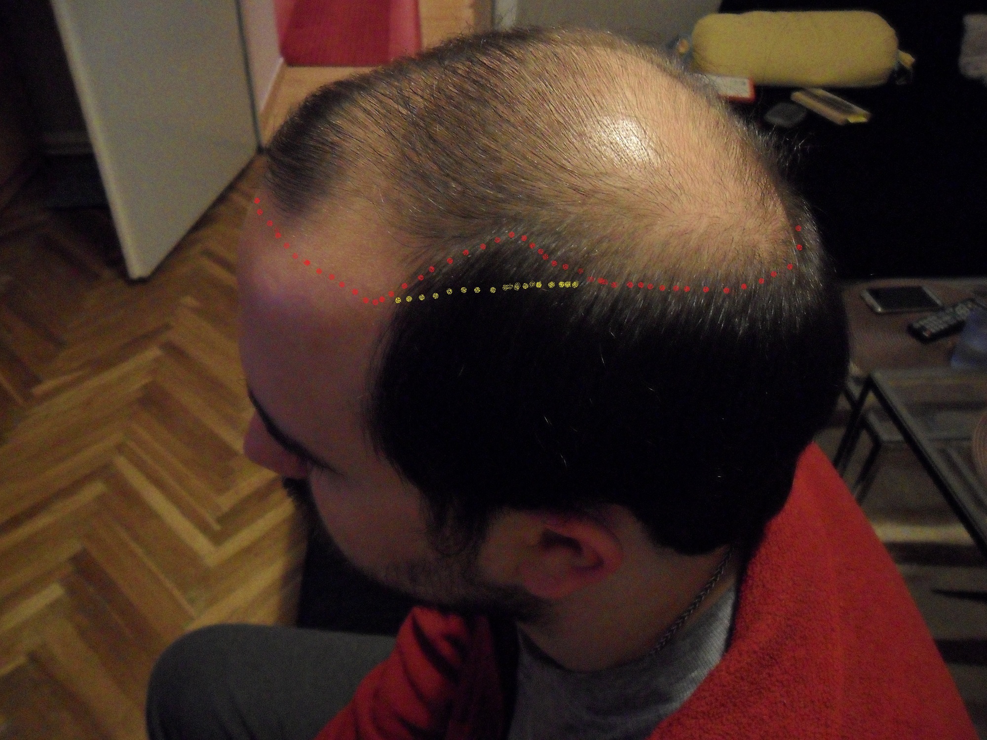 index.php/fa/14024/0/