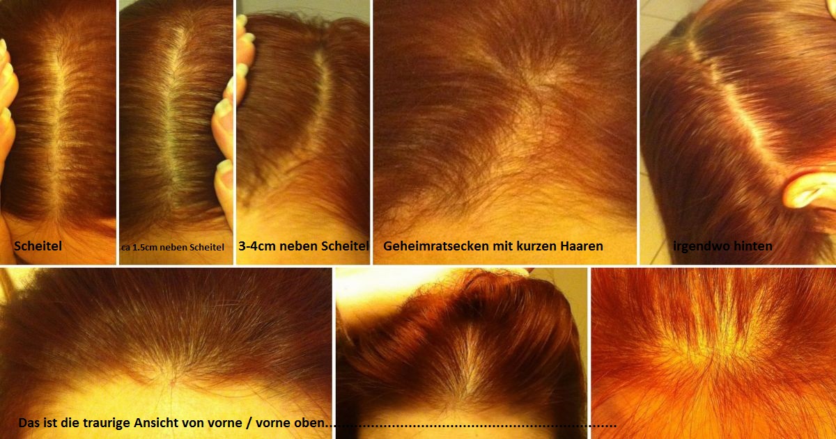 index.php/fa/14652/0/