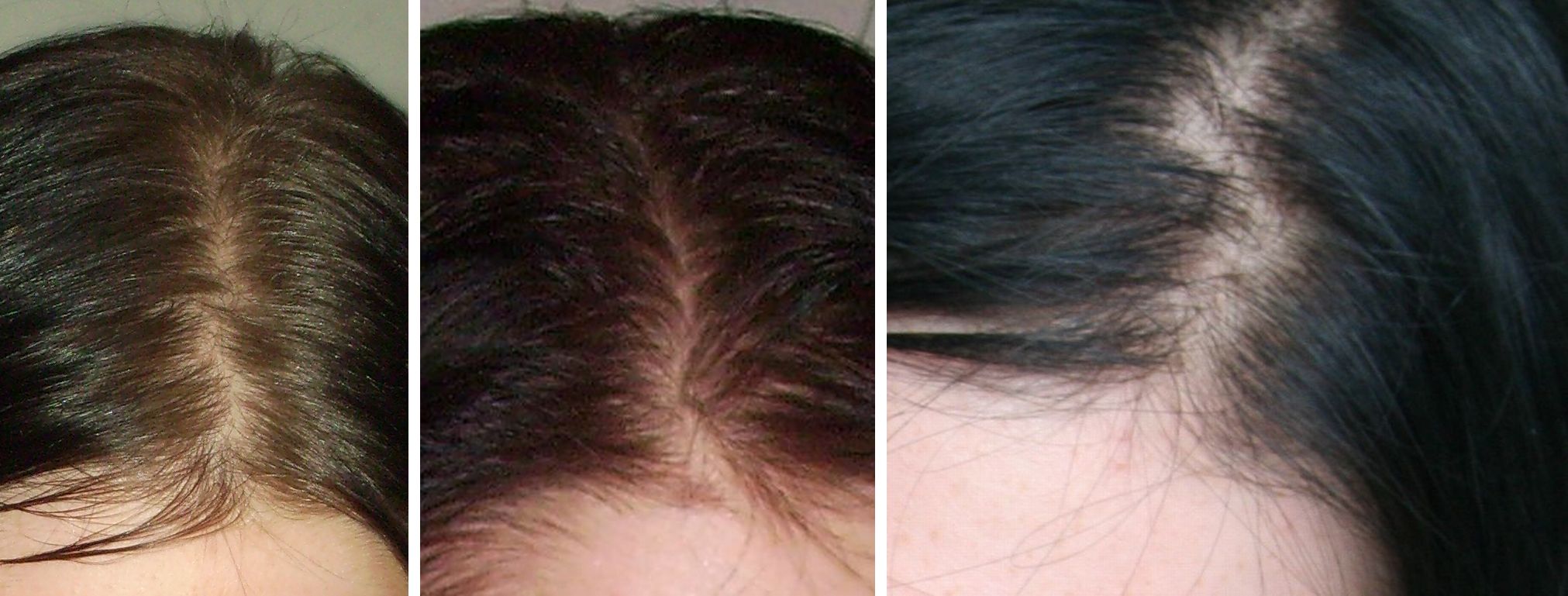 index.php/fa/14656/0/