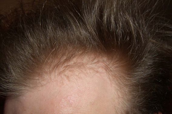 index.php/fa/1489/0/