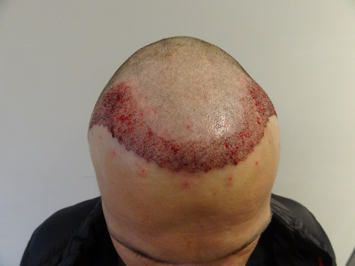 index.php/fa/15593/0/