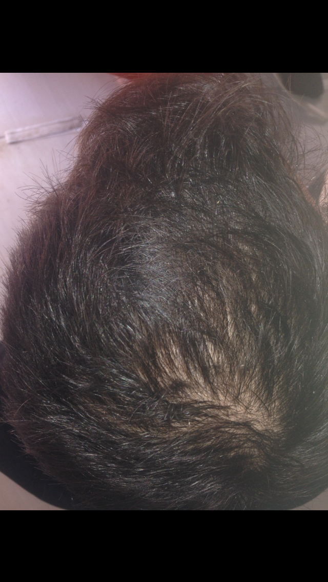 index.php/fa/17714/0/