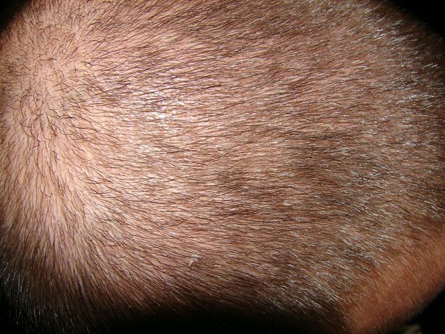 index.php/fa/1776/0/