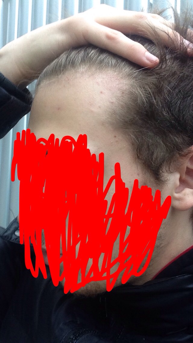 index.php/fa/17793/0/