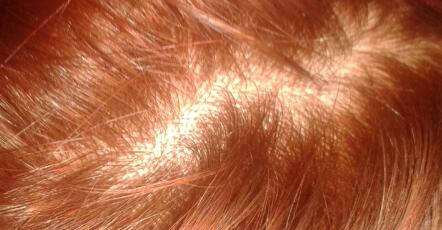 index.php/fa/17991/0/