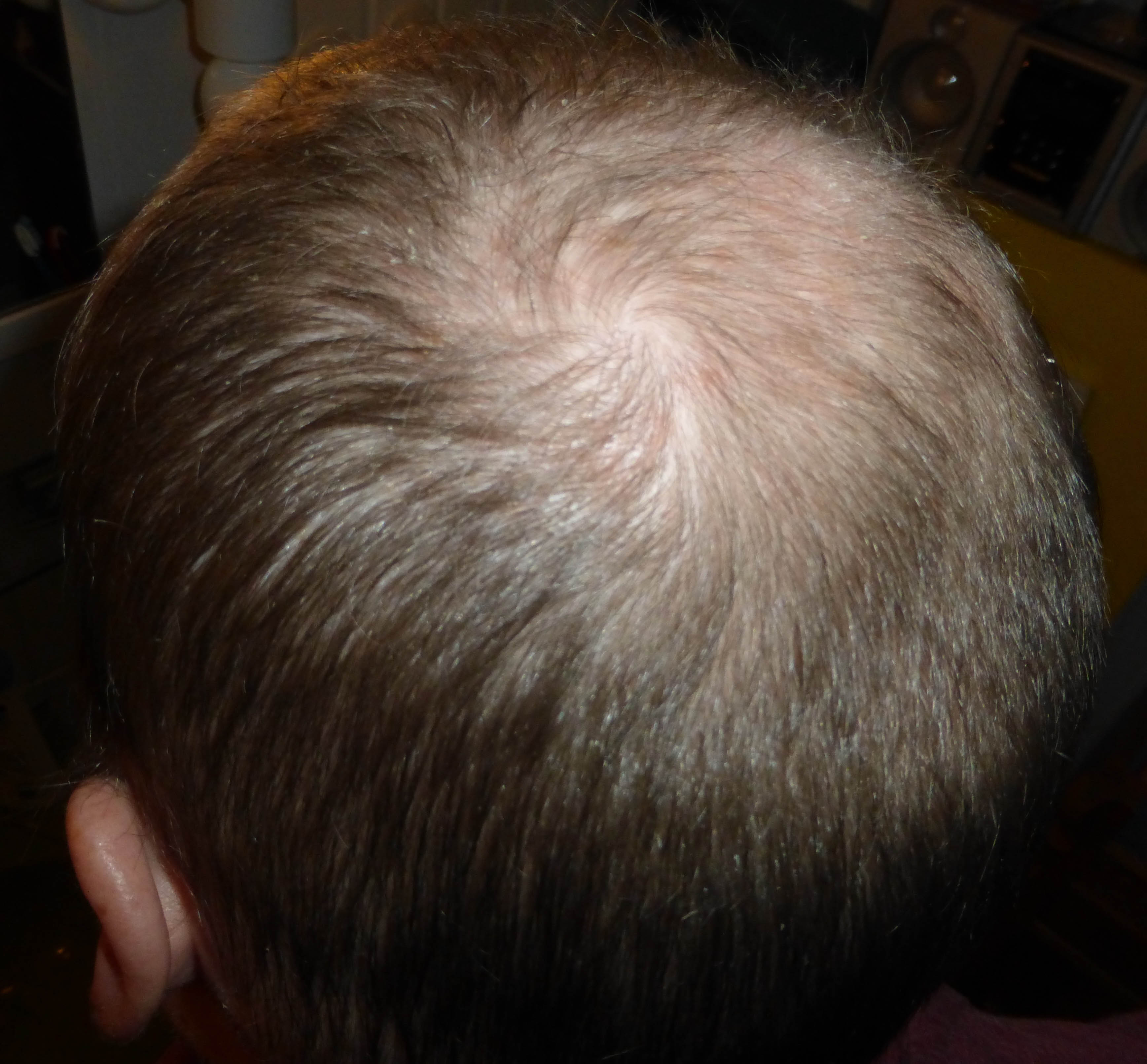 index.php/fa/18130/0/