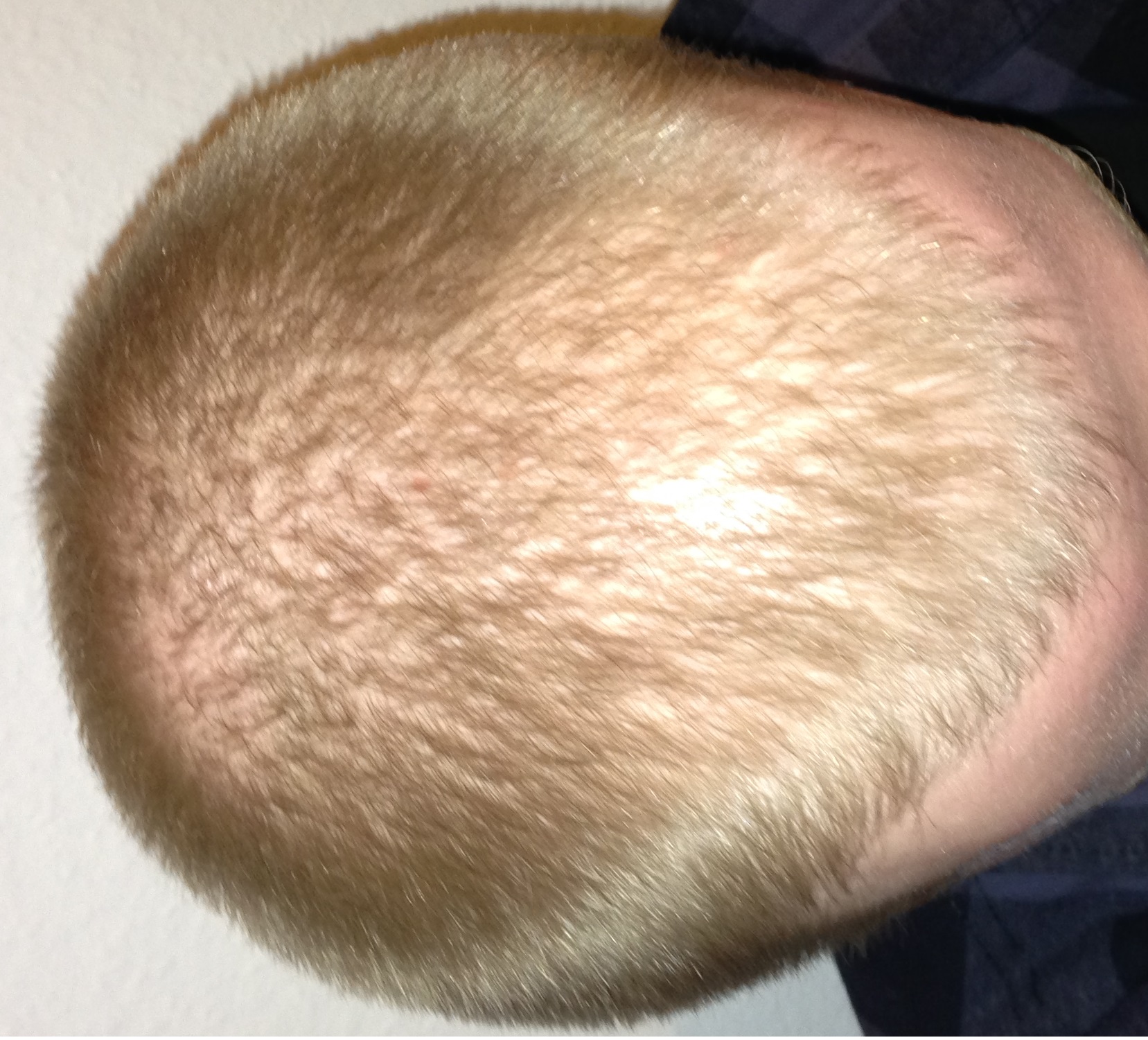 index.php/fa/18135/0/