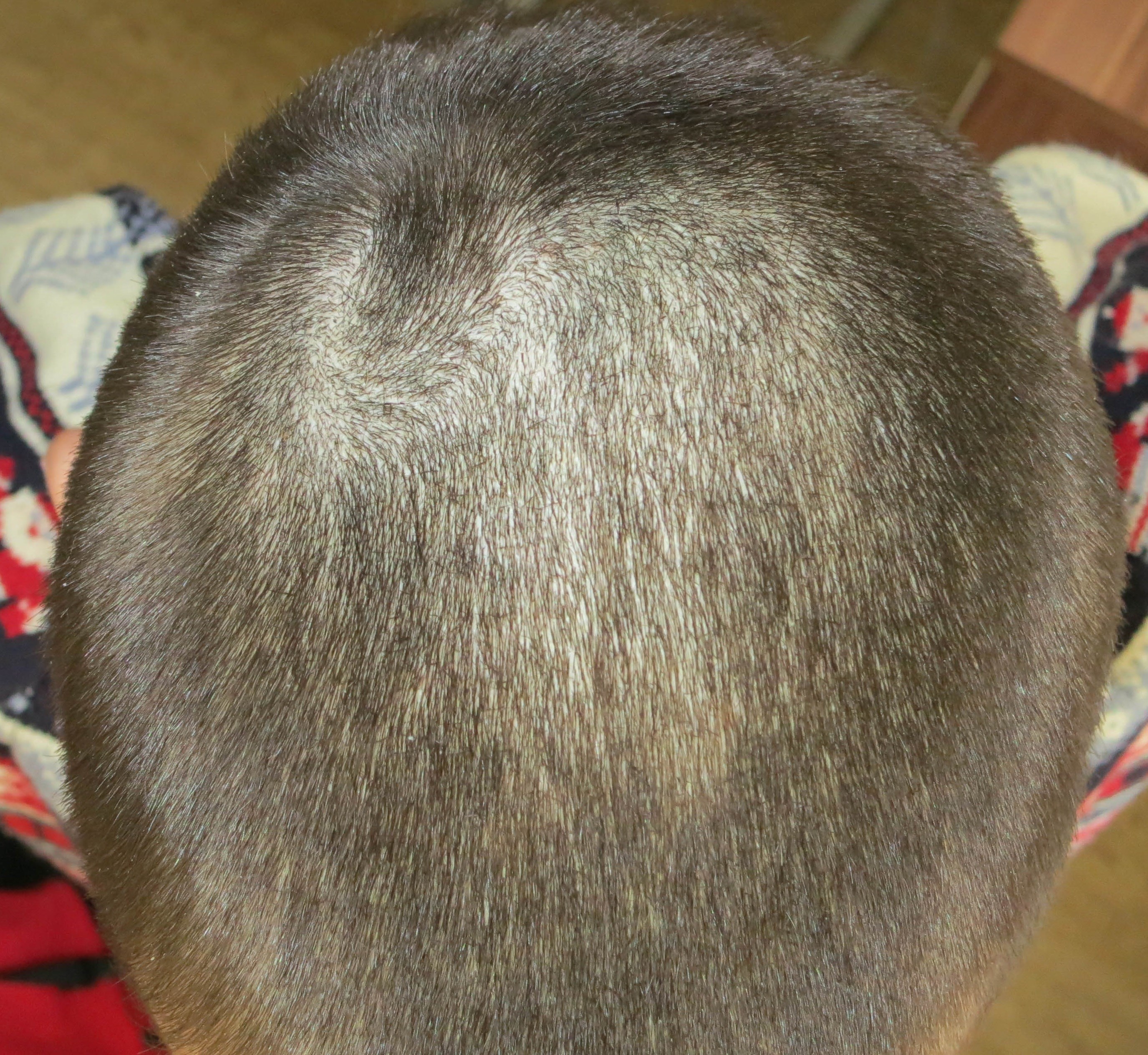 index.php/fa/18300/0/