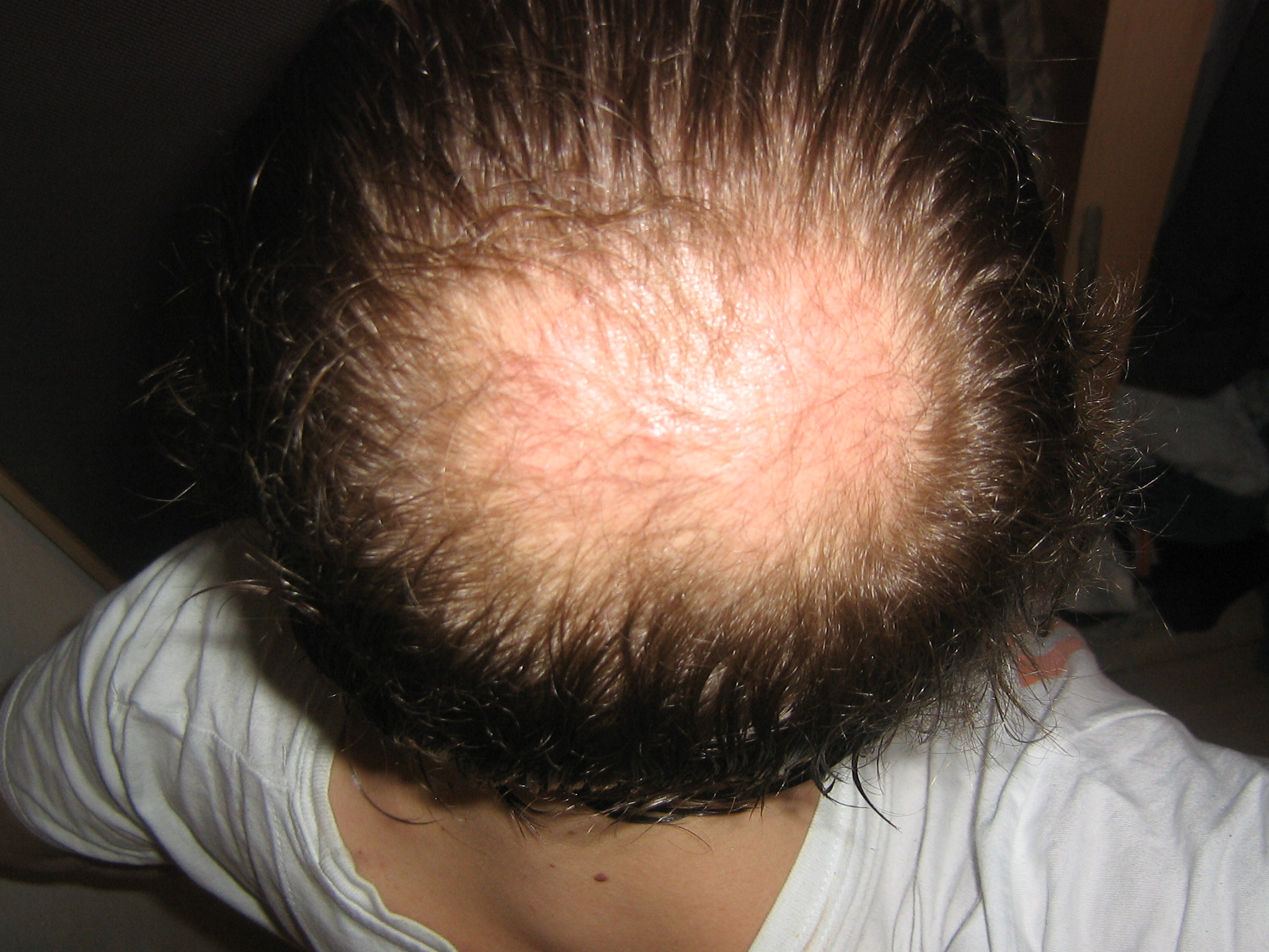 index.php/fa/18371/0/