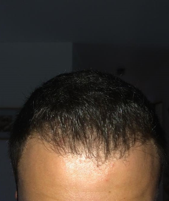 index.php/fa/18701/0/