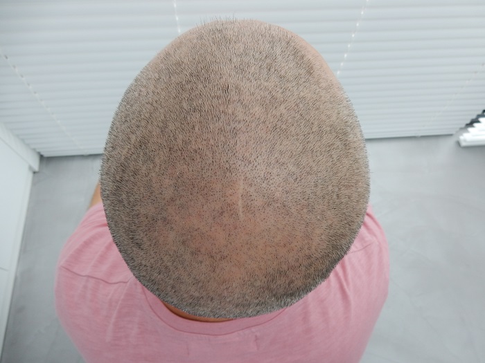 index.php/fa/19454/0/