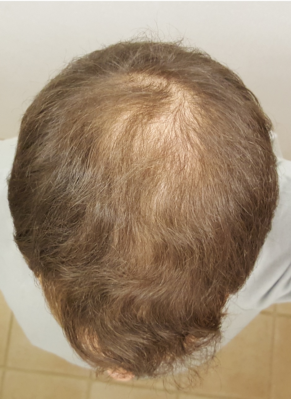 index.php/fa/19458/0/