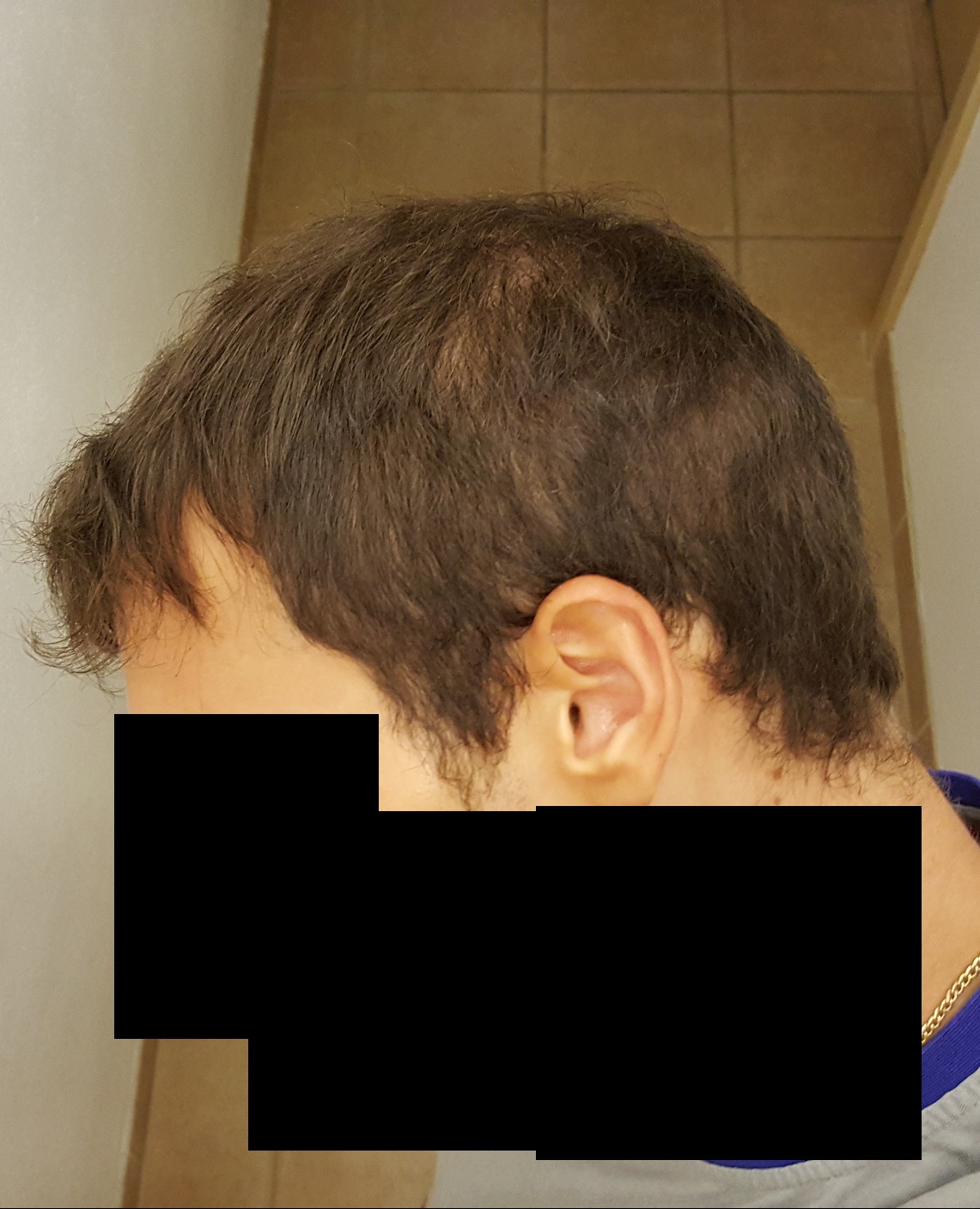 index.php/fa/19460/0/