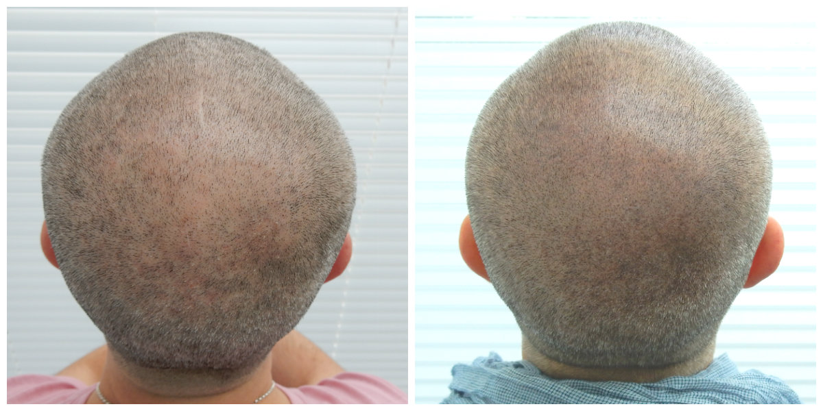 index.php/fa/19474/0/