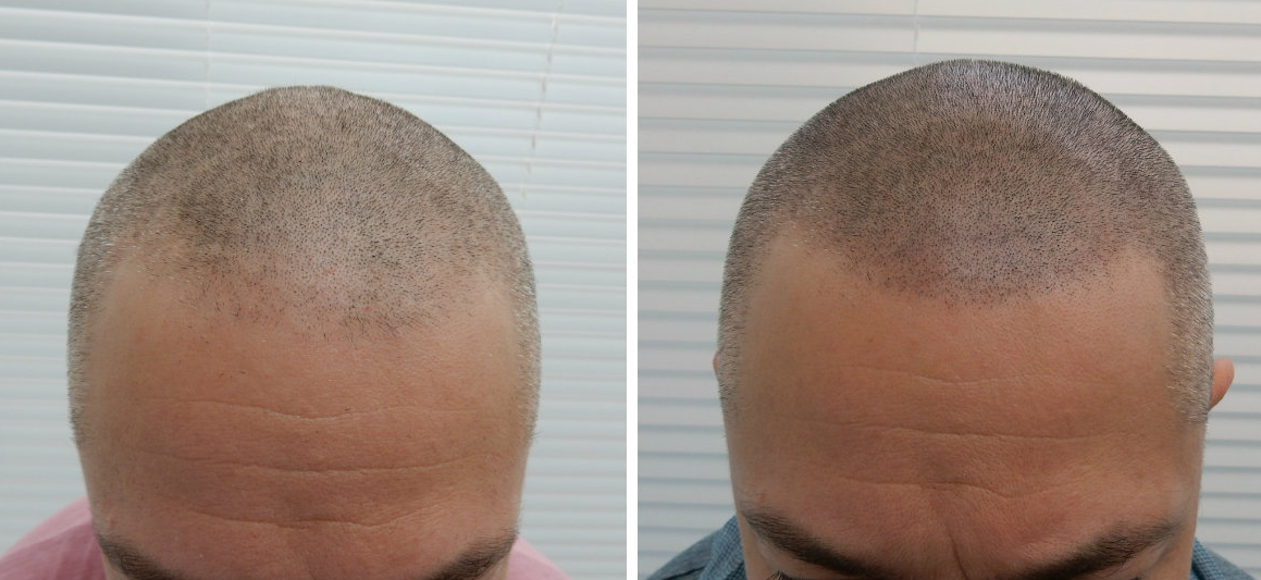 index.php/fa/19475/0/