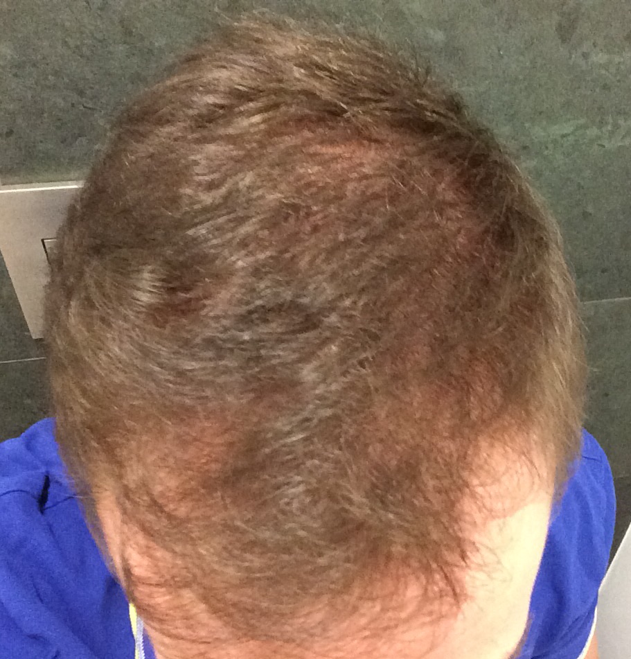 index.php/fa/19545/0/