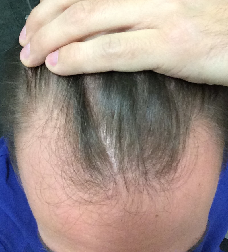 index.php/fa/19546/0/