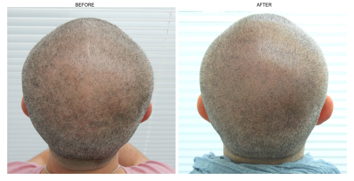 index.php/fa/19548/0/