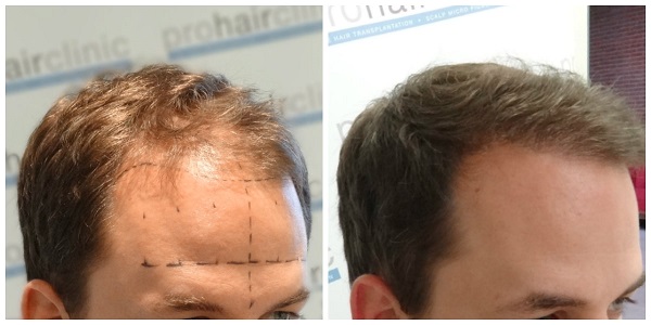 index.php/fa/19566/0/