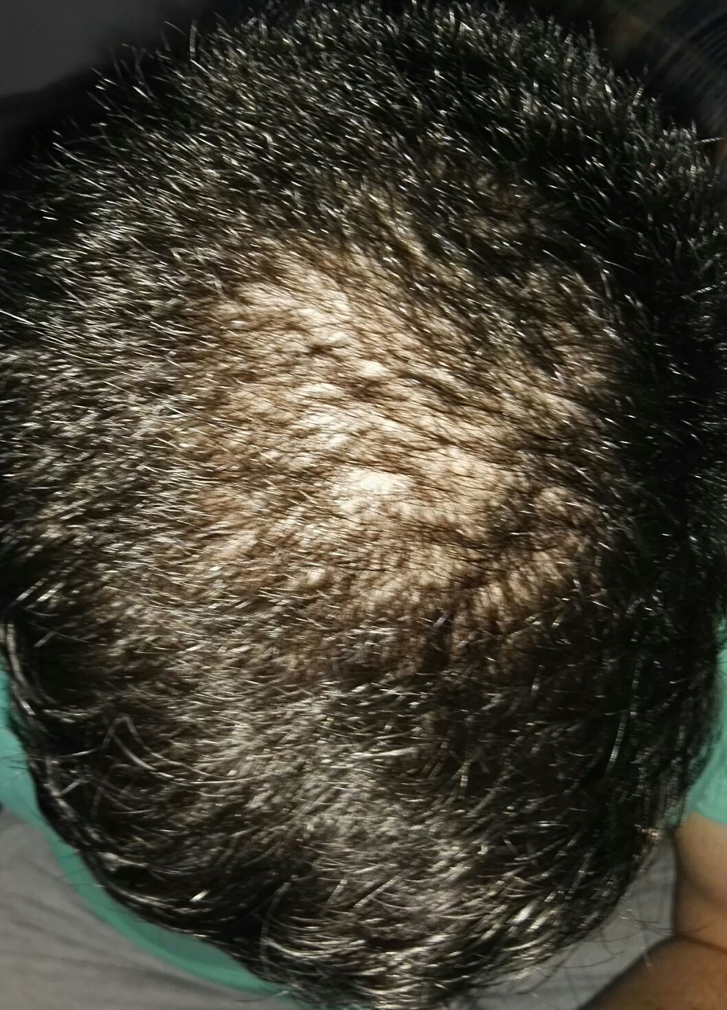 index.php/fa/20963/0/