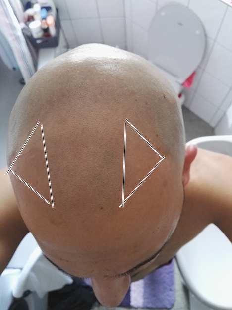 index.php/fa/21306/0/