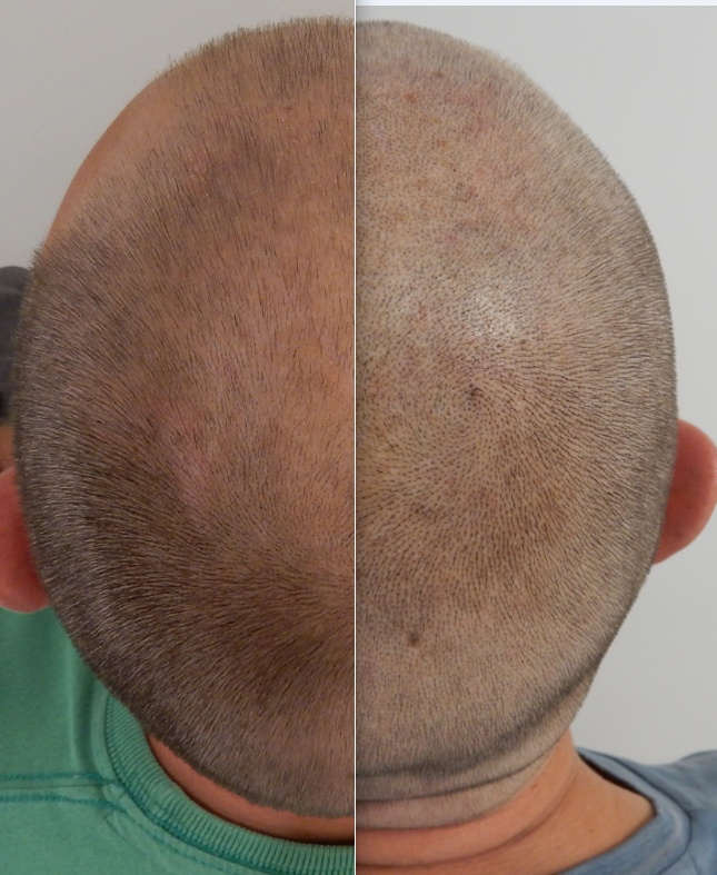 index.php/fa/21375/0/