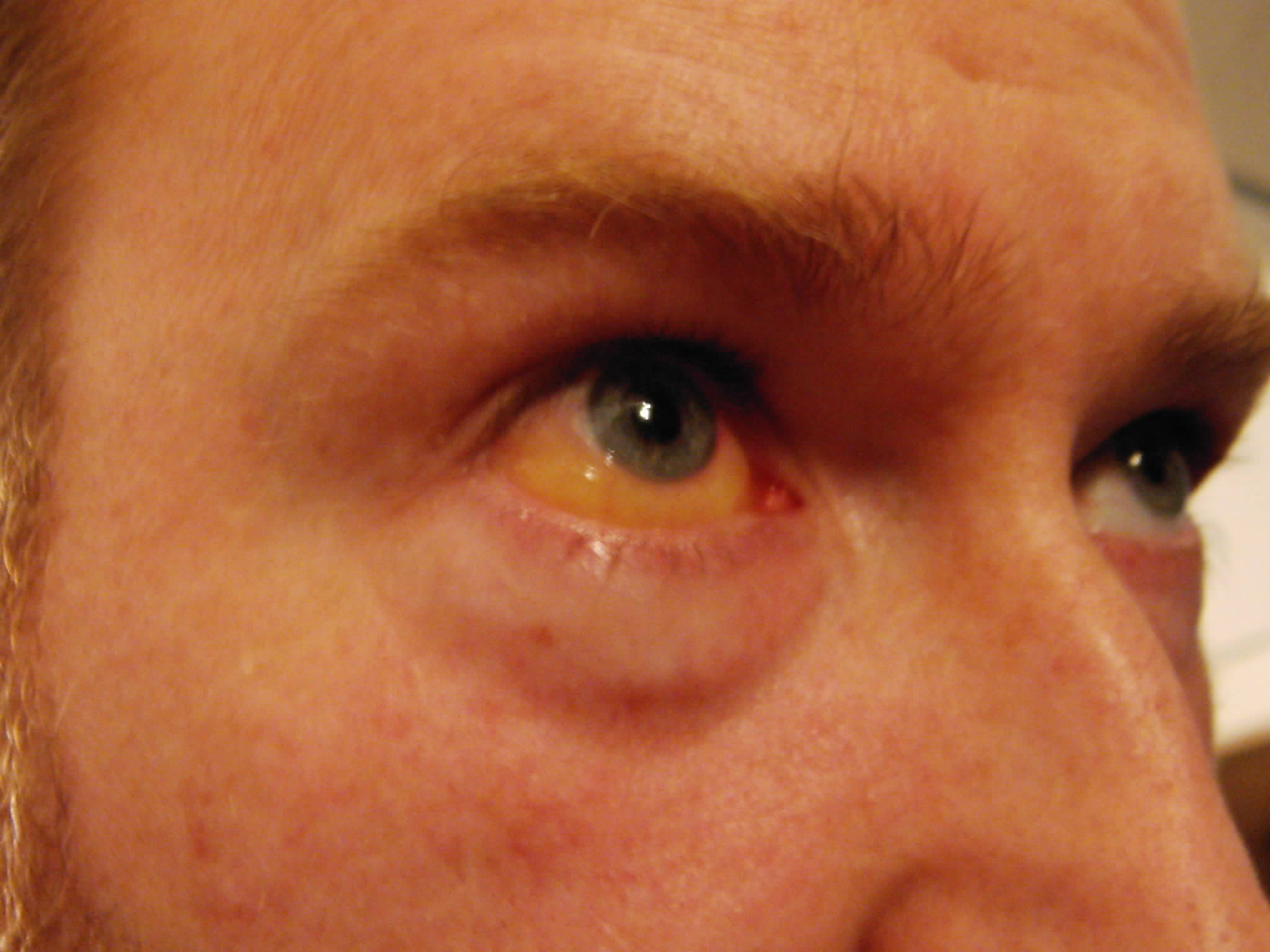 index.php/fa/2141/0/