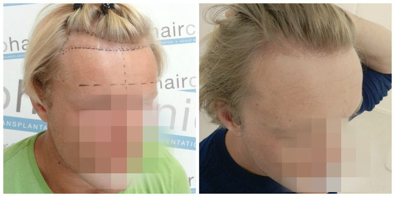 index.php/fa/22751/0/