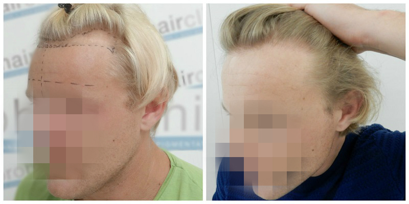 index.php/fa/22753/0/