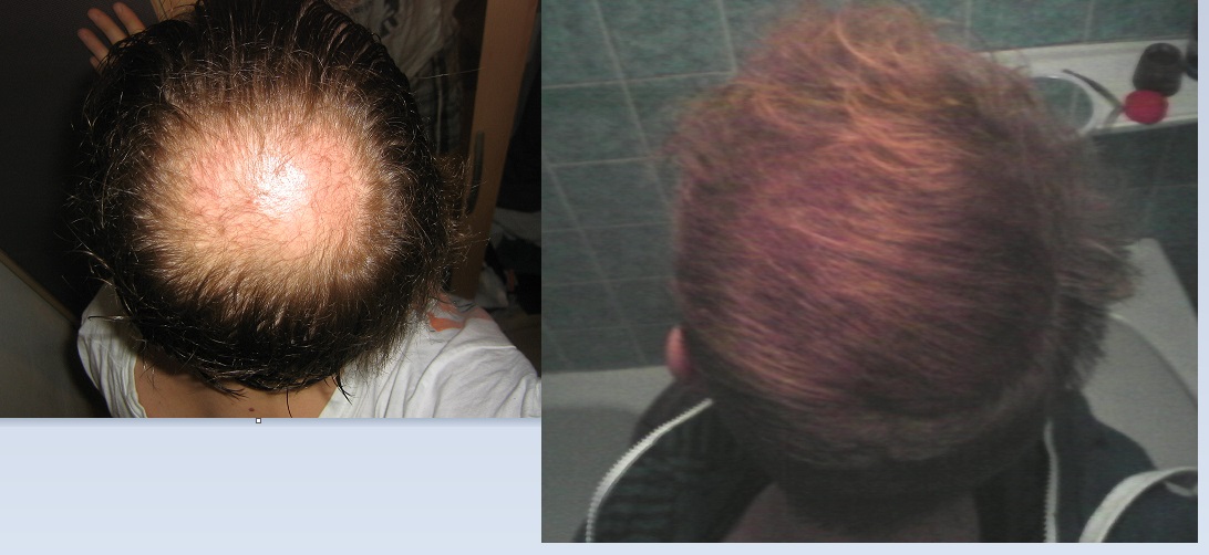 index.php/fa/23387/0/