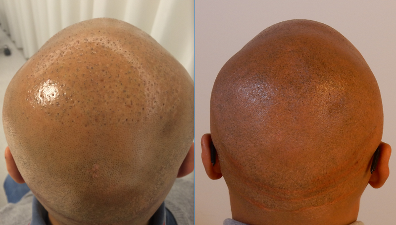 index.php/fa/23645/0/