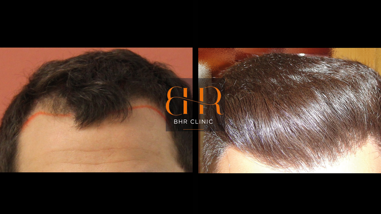 index.php/fa/23936/0/