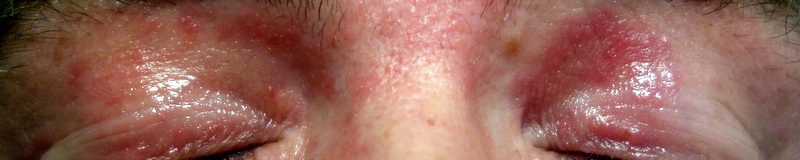 index.php/fa/24394/0/