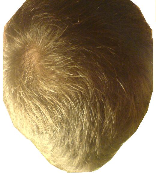 index.php/fa/2441/0/