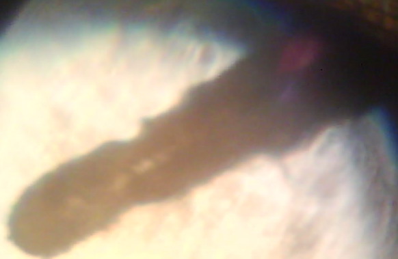 index.php/fa/2504/0/