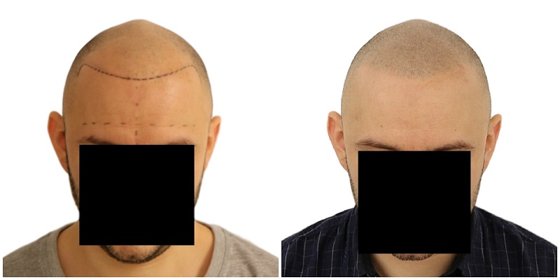 index.php/fa/25121/0/