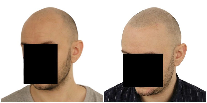 index.php/fa/25122/0/