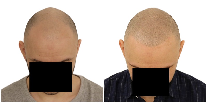 index.php/fa/25123/0/