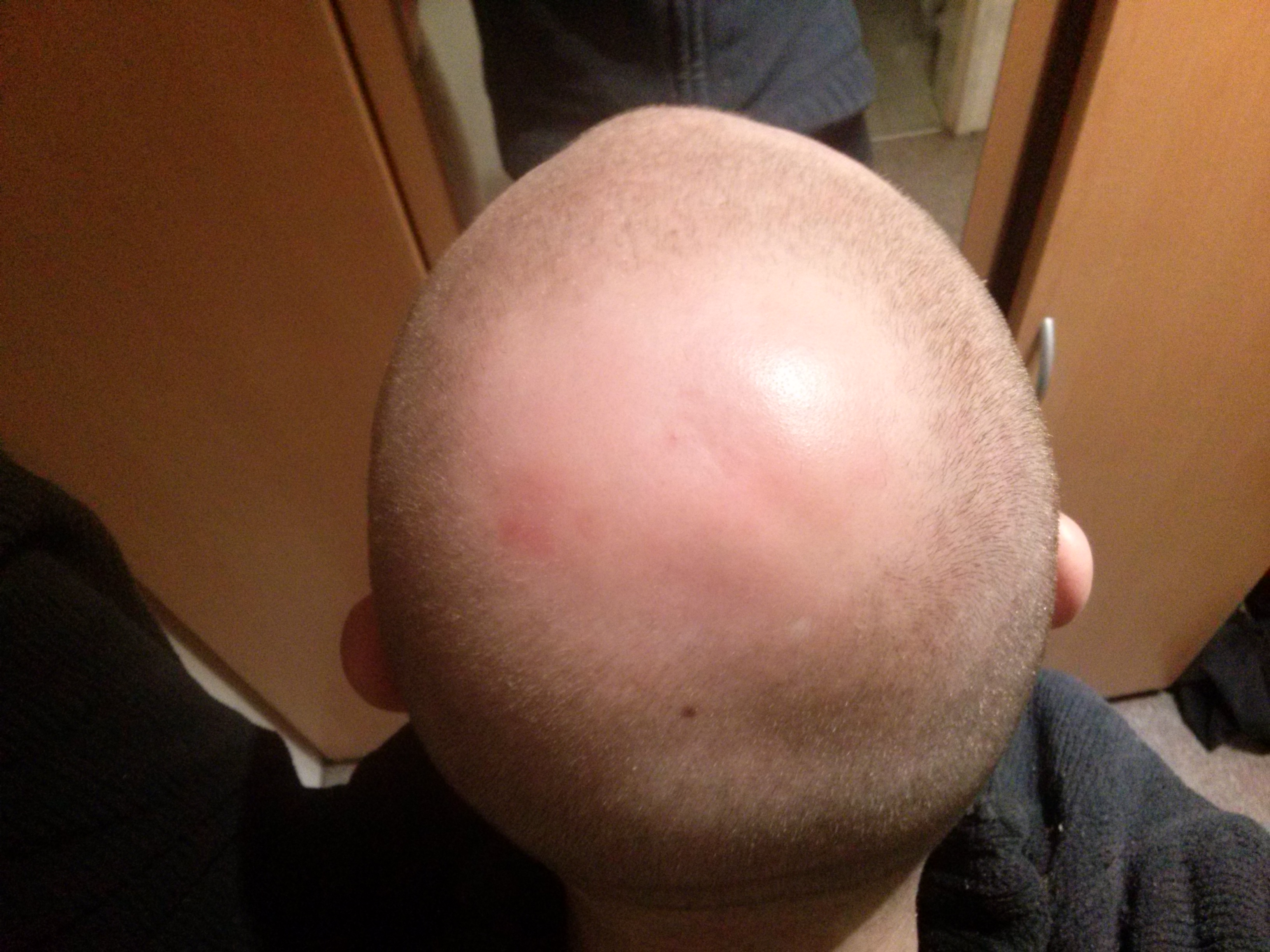 index.php/fa/25411/0/