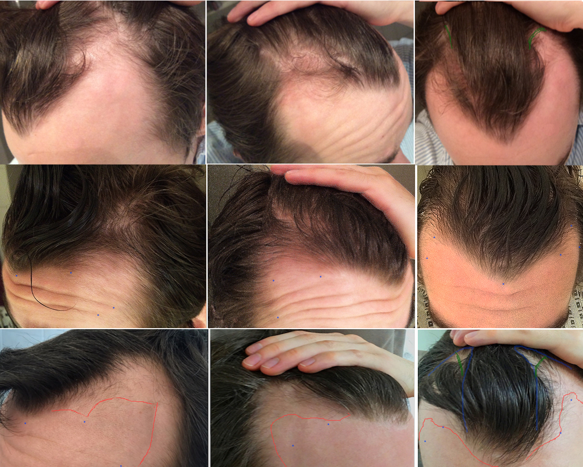 index.php/fa/25666/0/