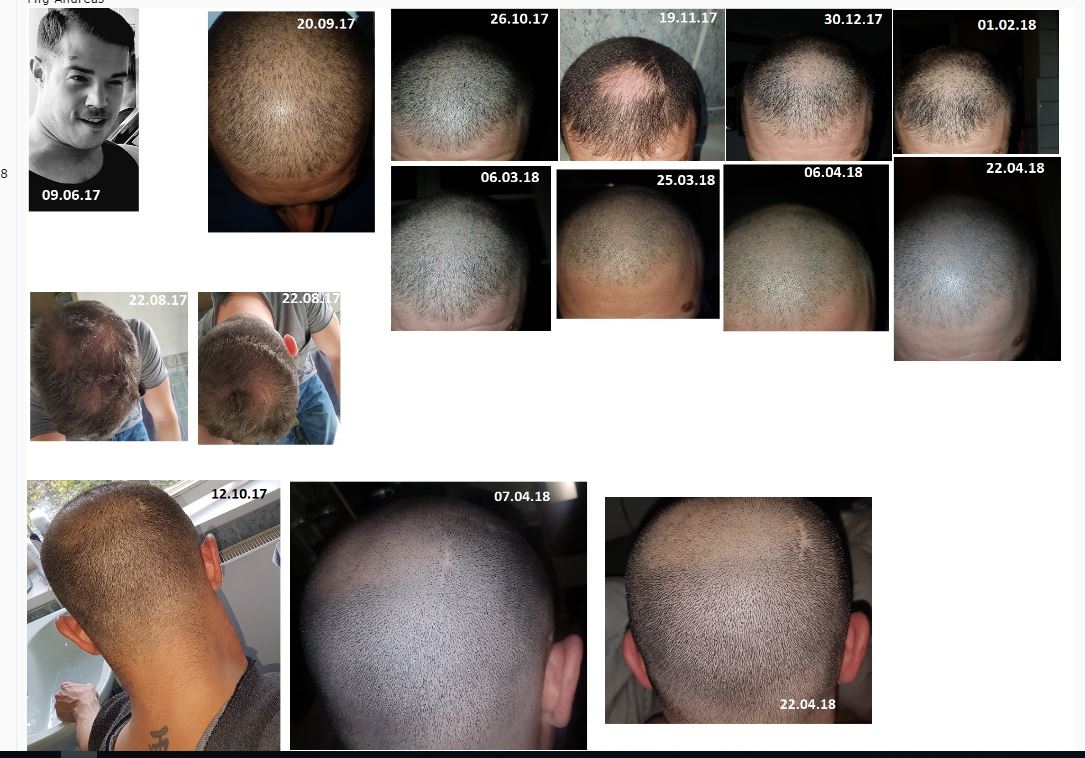 /fud/index.php/fa/26100/0/