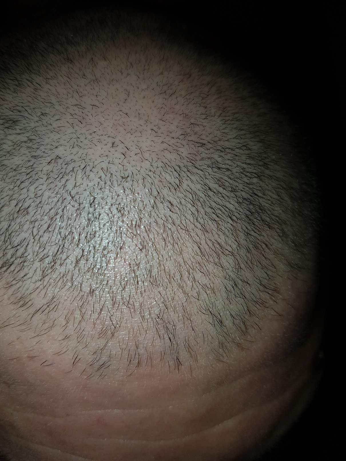 /fud/index.php/fa/26104/0/