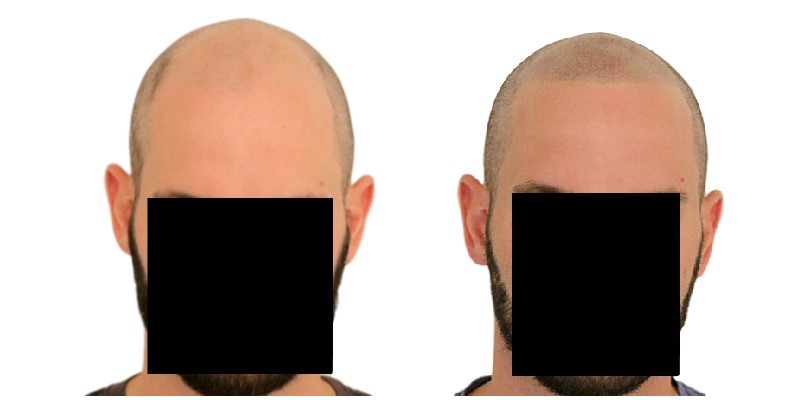 /fud/index.php/fa/26298/0/