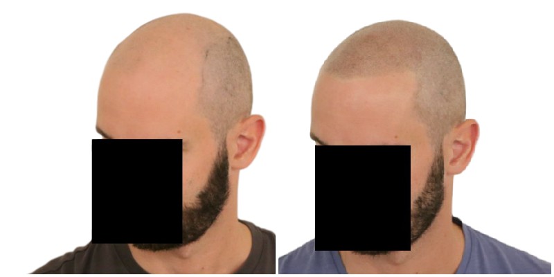 /fud/index.php/fa/26299/0/